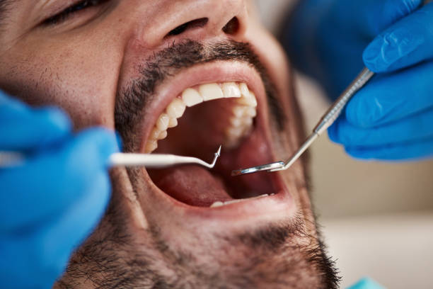 Best Orthodontic Emergency Dentist in Flowery Branch, GA