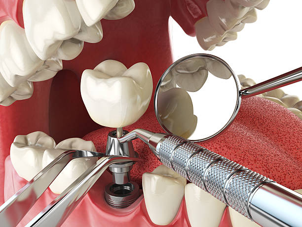 Best Holiday Emergency Dentist in Flowery Branch, GA